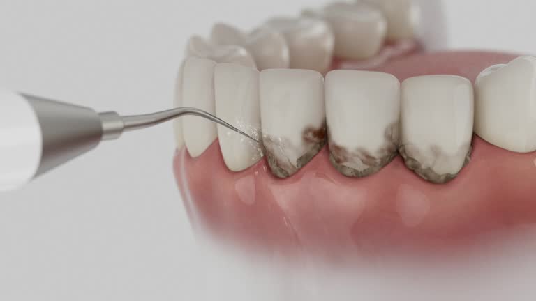 Reliable Dental Implants contractor in Caney, KS by Smile Center Dentistry